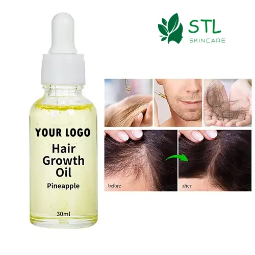 Hair Regrowth Oil